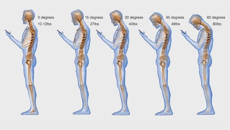 Text Neck: The Impact Looking Down At Your Phone Has On Your Neck & Spine 2 Text Neck: The Impact Looking Down At Your Phone Has On Your Neck & Spine