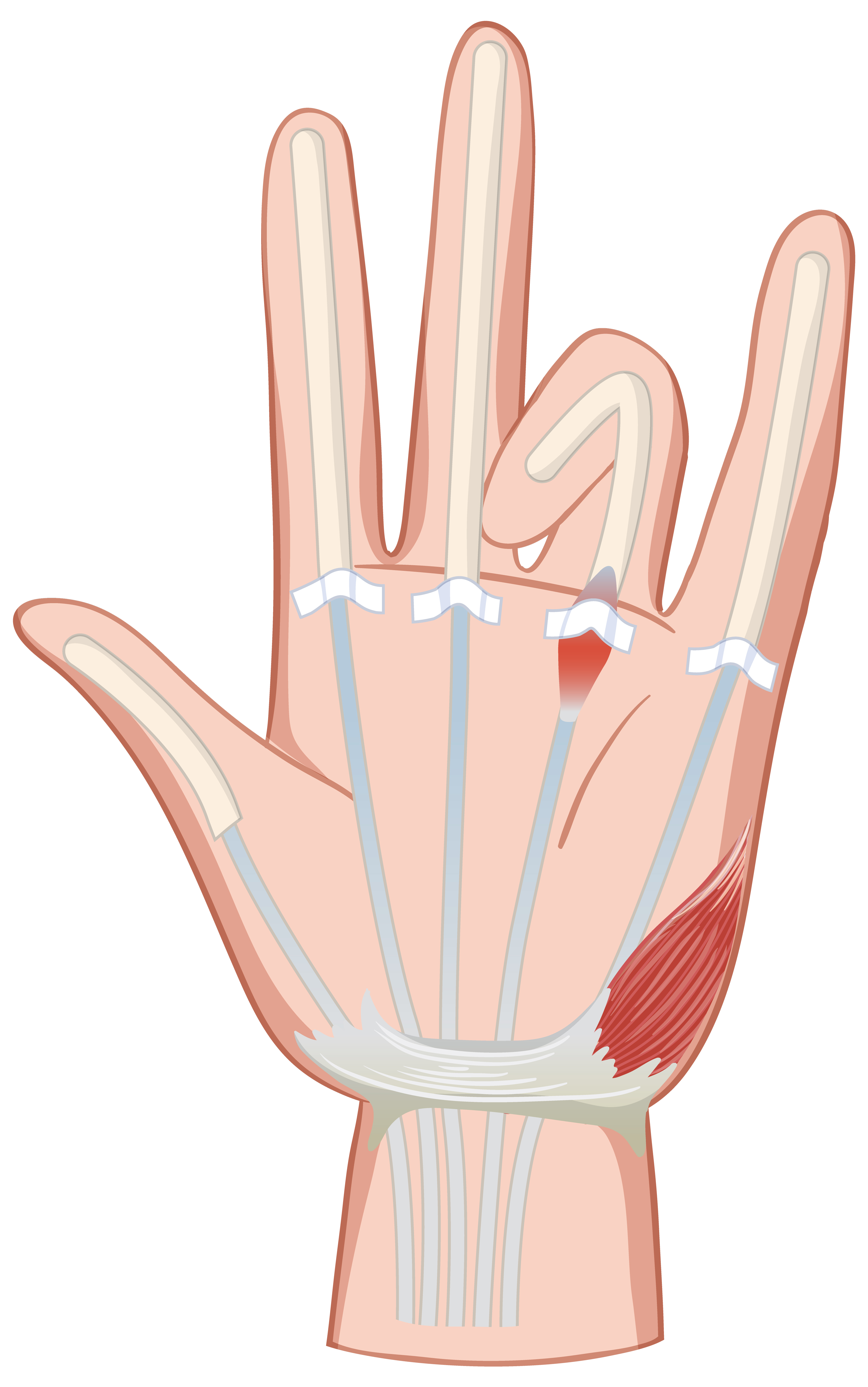 From Pain to Progress: Chiropractic Care for Carpal Tunnel Relief