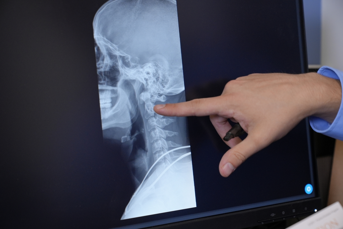 The Benefits of Chiropractic Adjustments for Neck Pain Relief 1 The Benefits of Chiropractic Adjustments for Neck Pain Relief